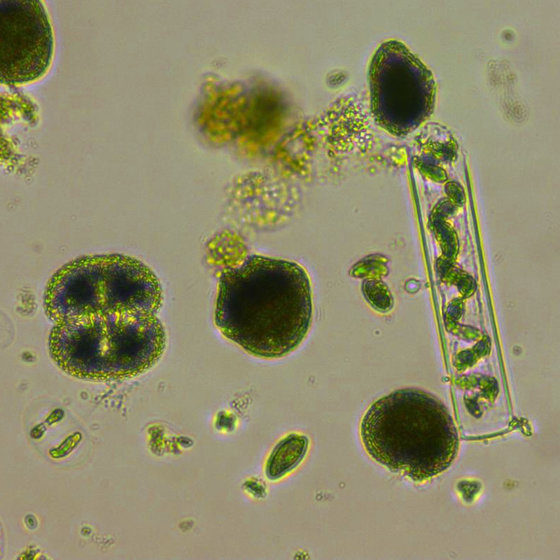 phytoplankton (photo credit Gabriel Yvon-Durocher)